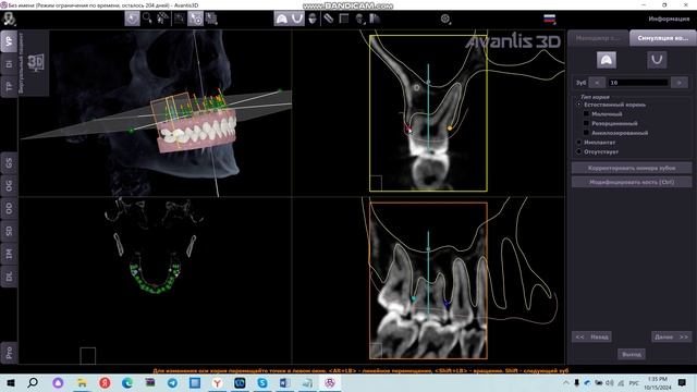 Построение корней по КТ