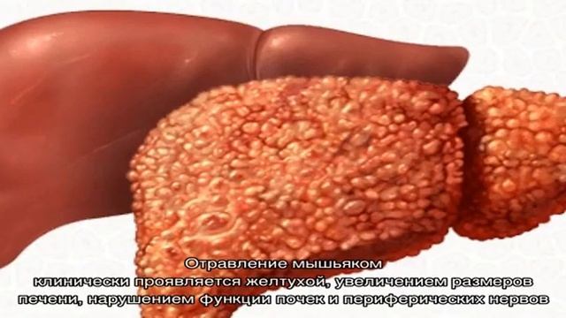 Токсический гепатит