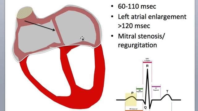 Basic Cardiology: Cardiac Cycle, Action Potential, and the QRS Complex смотреть онлайн