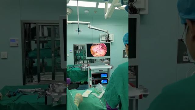 Laparoscopic adrenal tumor resection смотреть онлайн