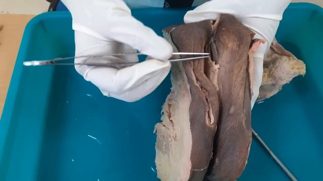 Gross Anatomy of Female External Genital Organ смотреть онлайн