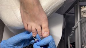 ПЕДИКЮР без покрытия | Обработка стопы песочными колпачками LUKAS