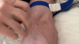 Как самому поставить капельницу и сохранить в кармане 15000₽