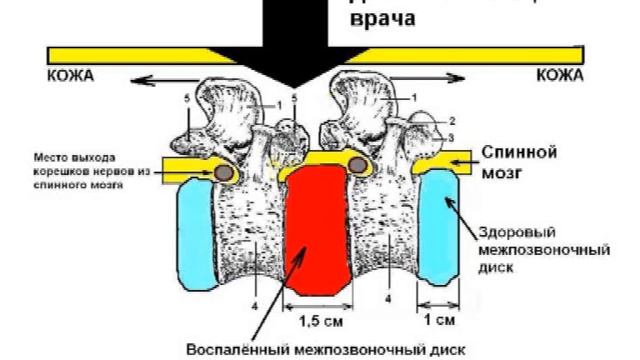 Acupressure смотреть онлайн