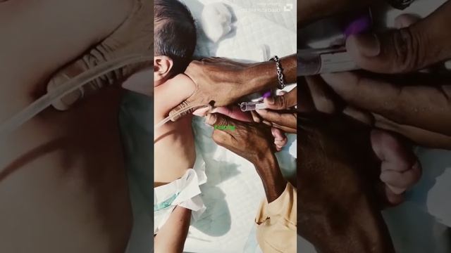 💯%completed procedures 💉 #how to do baby blood samples collection?🤱💊💯 смотреть онлайн