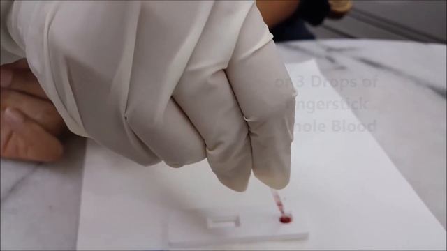 Hepatitis Free Malaysia - POCT test for Hepatitis B surface antigen (HBsAg) смотреть онлайн