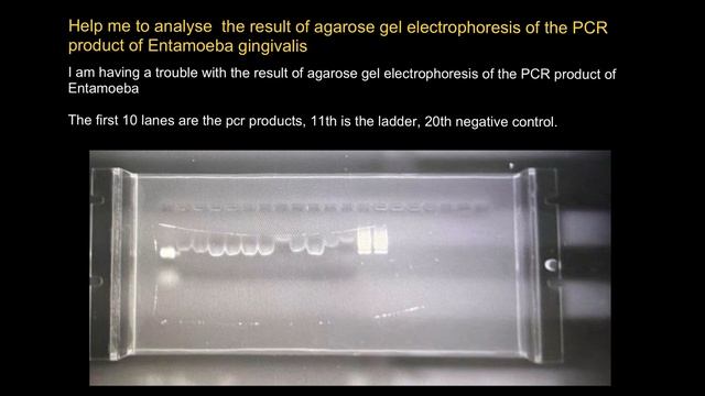 How to analyze result of agarose gel electrophoresis of the PCR product? смотреть онлайн