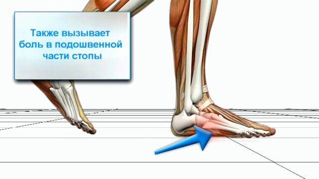 Биомеханика распространённой ходьбы смотреть онлайн