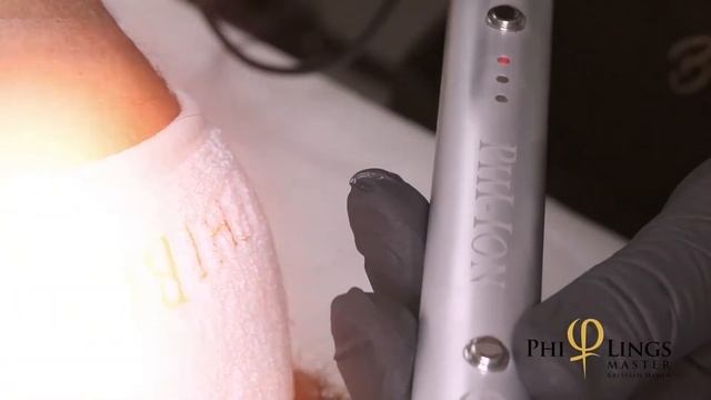 Microneedling & Phi-Ion (Plasma) / PhiLings смотреть онлайн