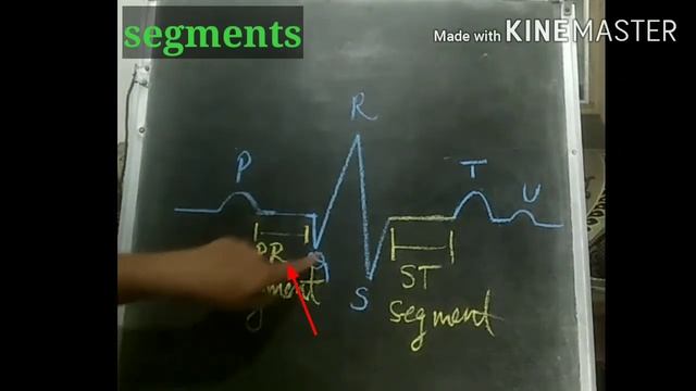 * What does PQRST ECG waves represents, segments and intervals,what they denote,more about P wave смотреть онлайн