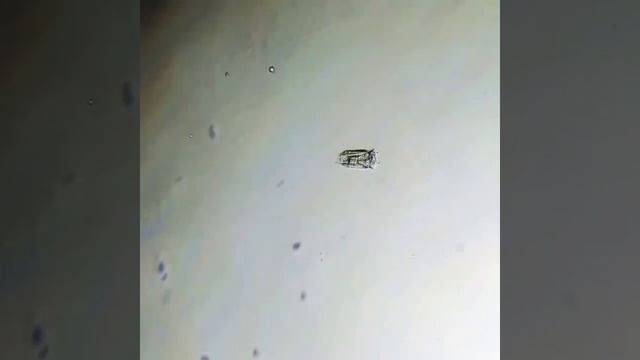 Extreme Acceleration! Watch how fast a Polyarthra rotifer jumps. #biology #microscope #biomechanics смотреть онлайн