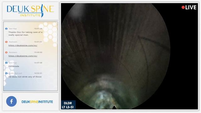 Watch Live Back Treatment! DLDR LT L3-S1 смотреть онлайн