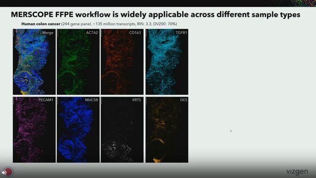 In situ single cell transcriptomic imaging in formalin fixed paraffin embedded FFPE tissues with ME смотреть онлайн