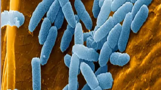 Bacteriology, Escherichia Coli and Pseudomonas Aeruginosa смотреть онлайн
