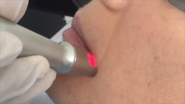 K LASER BLUE DERMA ENGL смотреть онлайн