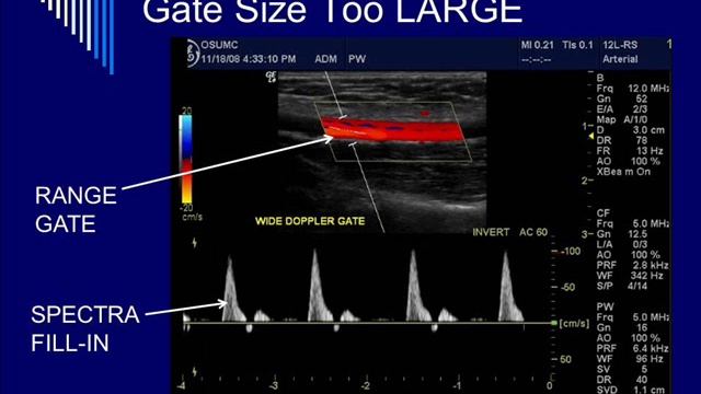 Doppler Instrumentation and Color Doppler - Segment #3 смотреть онлайн
