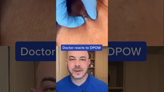 Doctor reacts to massive DPOW! #dermreacts #doctorreacts #DPOW смотреть онлайн