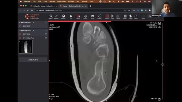 Monthly Case Webinar with Dr. Imran Lasker - #14 смотреть онлайн