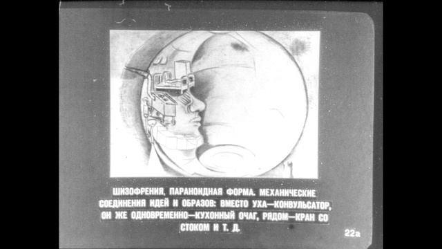 Диафильм Психиатрия 10 Шизофрения смотреть онлайн