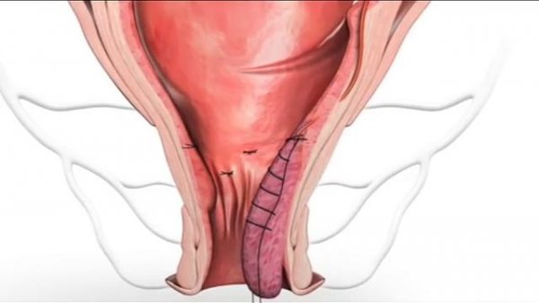 AMI animation HAL RAR 2010