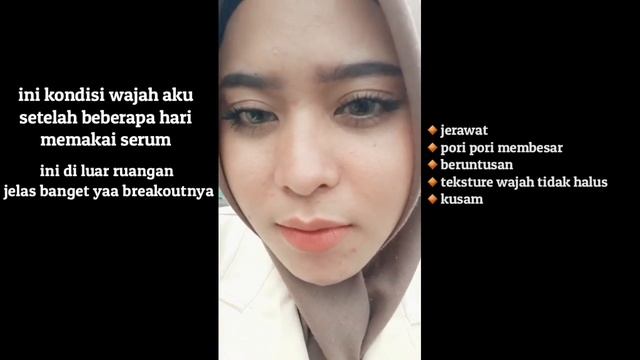 NACIFIC FRESH CICA SERUM SETELAH BERUBAH MENJADI NACIFIC GREEN PAIR SERUM,Gimana Hasilnya??? смотреть онлайн