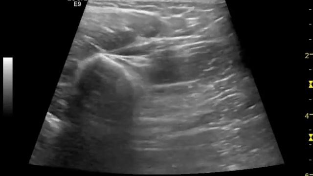 N radialis смотреть онлайн