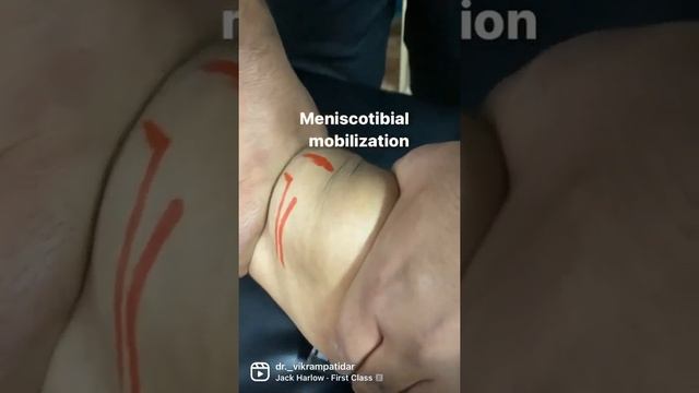 Meniscotibial mobilization. смотреть онлайн