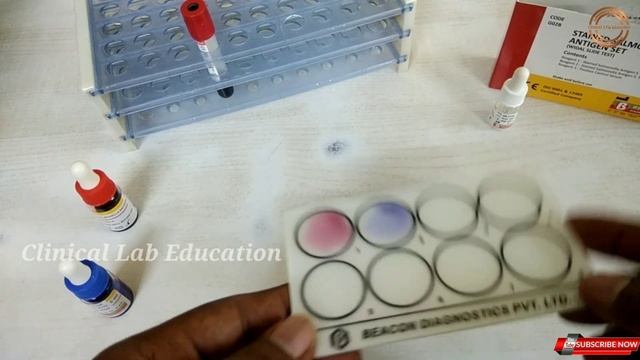 Typhoid Test | Widal Slide Test | Detection Of Salmonella Bacteriam in Telugu смотреть онлайн