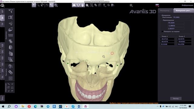 Измерение расстояний