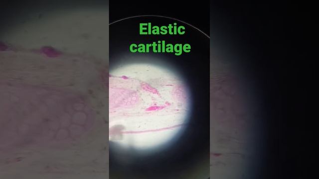 Elastic cartilage microscopic view #mbbs #medical #neet2023 #study #shortsmbbs #neet #bmims смотреть онлайн