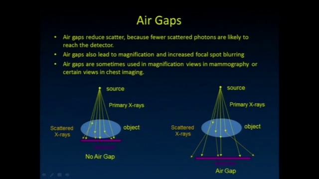 Scatter Radiation | Grid | Air Gap Technique | Daniel E. Wessell, M.D, pH.D. Mayo Clinic Florida смотреть онлайн