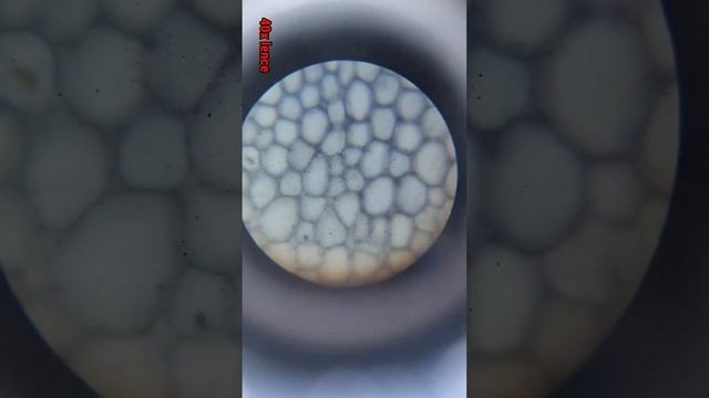 Parenchyma, Collenchyma, & Sclerenchyma Difference- الفرق بين البرنشيميه والكولنشيميه والاسكلرنشيمي смотреть онлайн