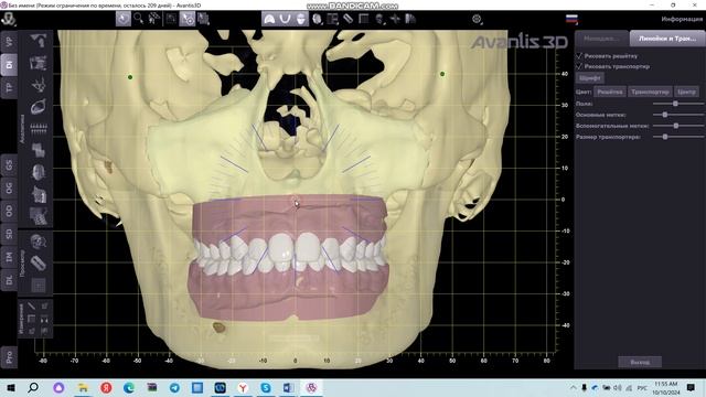 Измерительная решетка и транспортир