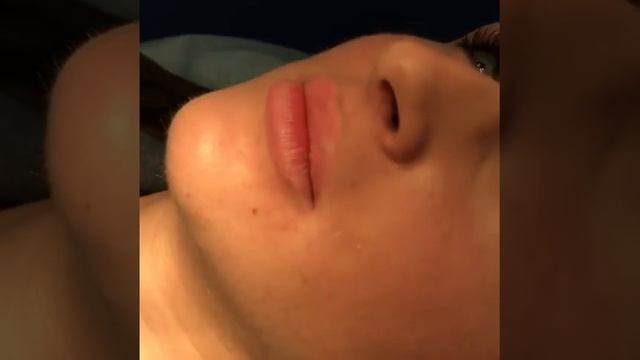 Максим Иванчук: Как увеличить объем губ? Коррекция зоны губ | Гиалуриновая кислота смотреть онлайн