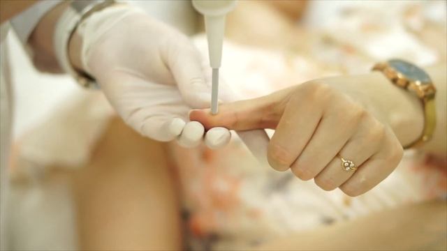 Криодеструкция смотреть онлайн
