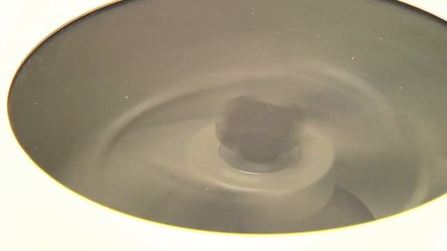 Platelet Rich Plasma (PRP) Therapy смотреть онлайн