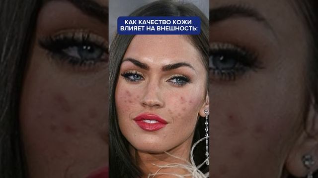 Запись на преображение вашей кожи по ссылке в шапке профиля #косметология #уход #допосле смотреть онлайн
