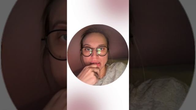 Гиалуроновая кислота для лица. Гиалуронка в губы #ольгаеременко #стоматолог смотреть онлайн