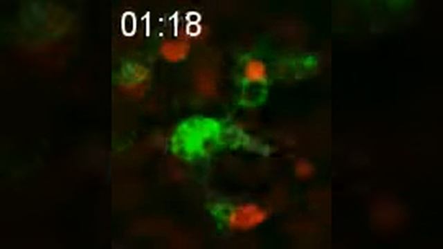 Microglial_phagocytosis_dead_cell смотреть онлайн