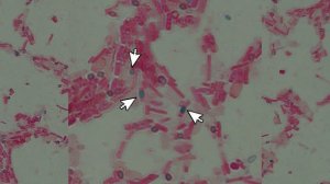 Bacillus