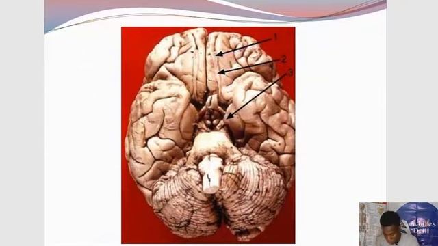 INFERIOR VIEW of the Brain ||Common NEUROANATOMY STEEPLECHASE Questions (PART 3) смотреть онлайн