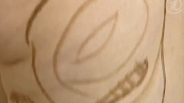 Липосакция мифы и правда! смотреть онлайн