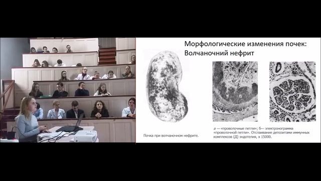 2018 11 01 ч04 Круглый стол с участием ООБМУ и ОНМедУ в малой анатомической аудитории Каплун Анаста смотреть онлайн