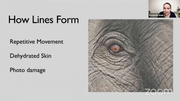 Tips for Success with Intradermals and Acupuncture!