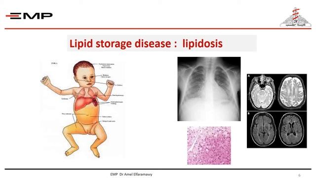 Chronic liver disease in children segment 2 смотреть онлайн