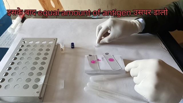 Brucella Test|agglutination test by brucella rose bangal antigen-गाय भैंस का बार बार बच्चा गिरा जान смотреть онлайн