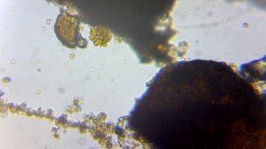 Водоросль пандорина (Большие академические пруды)