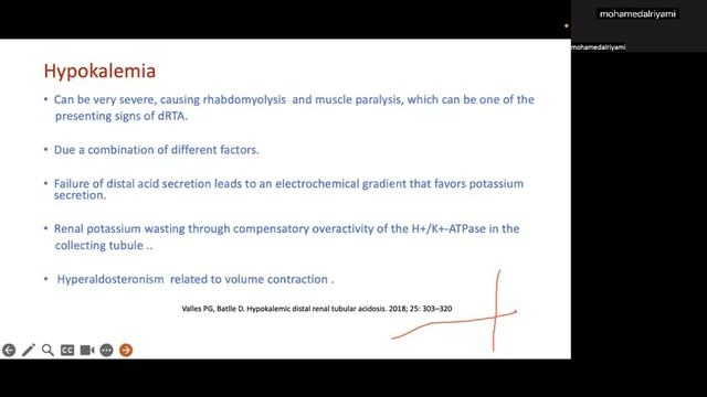 Recent Updates in the Management of Distal Renal Tubular Acidosis dRTA смотреть онлайн
