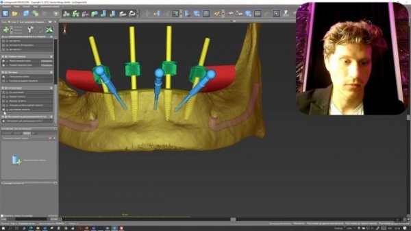 Разборный шаблон в coDiagnostiX
