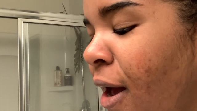 MY FIRST DIY MICRONEEDLING EXPERIENCE & WHAT TO EXPECT | SKINCARE ROUTINE FOR ACNE SCAR|DERMAROLLIN смотреть онлайн